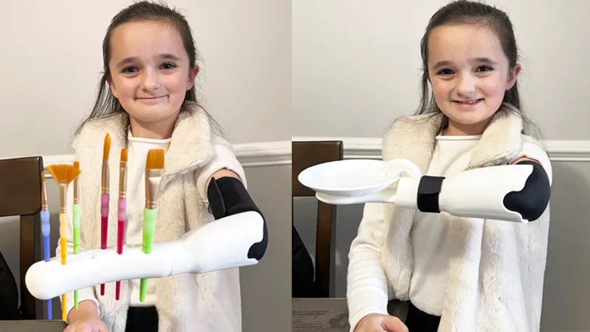 Student strávil 100 hodin u 3D tiskárny, aby své 7leté sestře vyrobil protézu. Dnes ji používá každý den